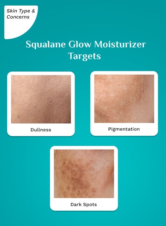 بيلجريم مرطب بيلغريم سكوالين ونياسيناميد وفيتامين سي للوجه (50 جم) | مرطب للبشرة الجافة | مرطب للوجه بفيتامين سي لبشرة متألقة | غير دهني | للجنسين - Image 4